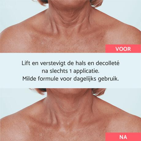 Remescar Hals & Décolleté 40 ML