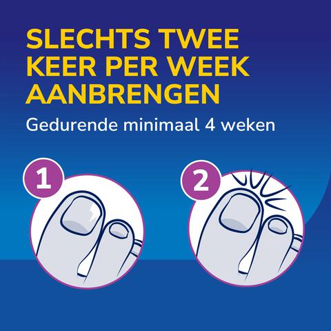 Dr.Scholl's Kalknagel 2 in 1 Behandel en Beschermset met 5 wegwerpvijltjes 3,8 ML