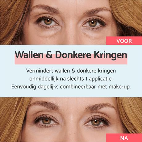 Remescar Wallen & Donkere Kringen Crème 8 ML
