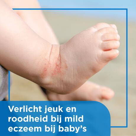 Bepanthen Eczeem Crème Baby Verlicht Jeuk En Roodheid Bij Mild Tot Matig Eczeem 20 GR
