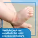 Bepanthen Baby Eczeem Crème 20 gram
