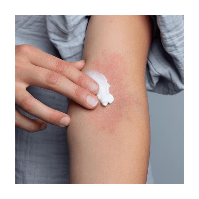 Gladskin Eczema Cream 15 ML