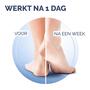 Scholl Active Repair K+ Klovenzalf 60 ML