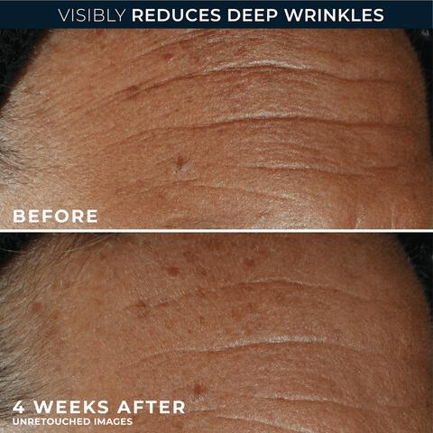 RoC Derm Correxion Fill + Treat Serum 15 ML