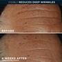 RoC Derm Correxion Fill + Treat Serum 15 ML