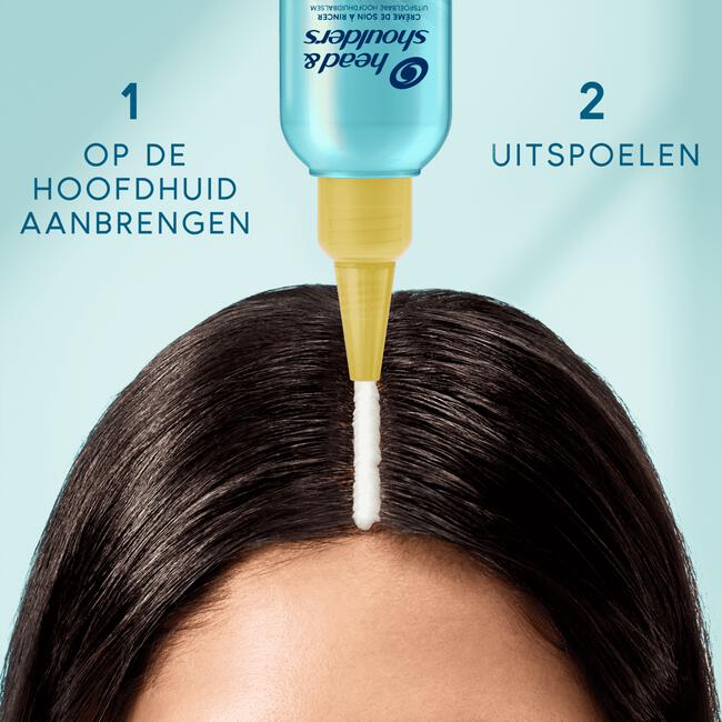 Head & Shoulders Derma X Pro Hydrateert Hoofdhuidbalsem Anti-roos 145ML