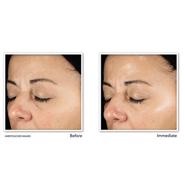 RoC Multi-Correxion Revive & Glow Daily Serum 30 ML
