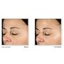 RoC Multi-Correxion Revive & Glow Daily Serum 30 ML
