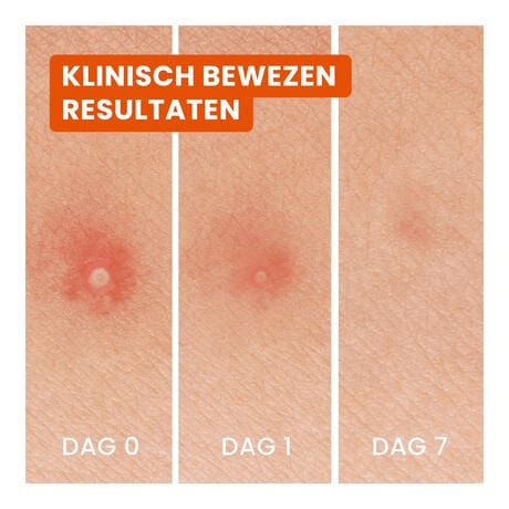 Biore Hydrocolloid Patch 24 stuks