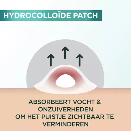 Garnier Pure Active Pimple Patch 22 stuks