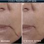 RoC Multi Correxion Firm+Lift Anti-Sagging Firming Cream 50 ML