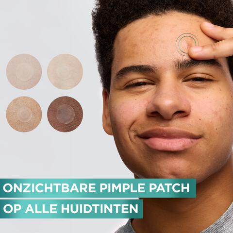 Garnier Pure Active Pimple Patch 22 stuks