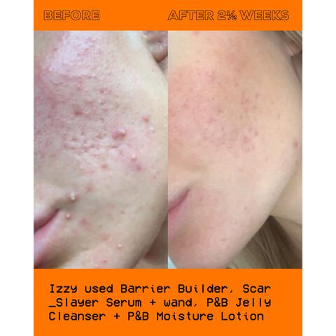 Glow Hub The Scar Slayer Facial Serum 30Ml
