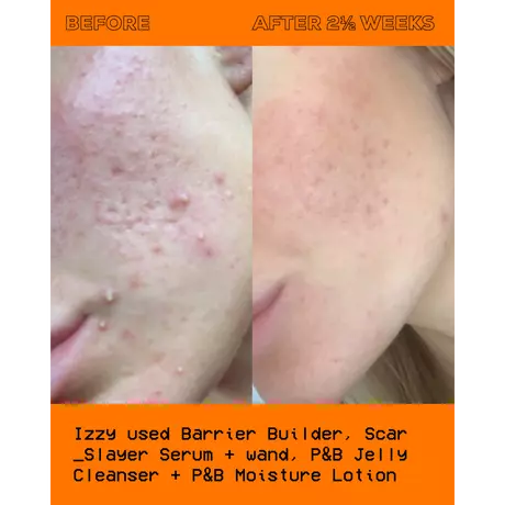 Glow Hub The Scar Slayer Facial Serum 30Ml