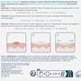 CeraVe Anti-Onzuiverheden Patches 22 stuks