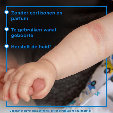 Bepanthen Eczeem Crème Baby Verlicht Jeuk En Roodheid Bij Mild Tot Matig Eczeem 20 GR
