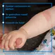 Bepanthen Baby Eczeem Crème 20 gram