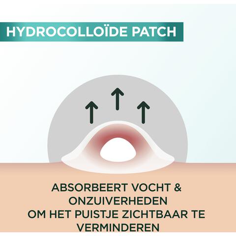 Garnier Pure Active Pimple Patch 22 stuks