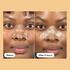 Hero Mighty Patch Nose 10 Stuks