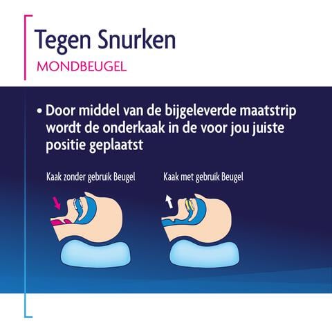 Shiepz Mondbeugel Tegen Snurken