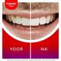 Colgate Max White Overnight Whitening Pen
