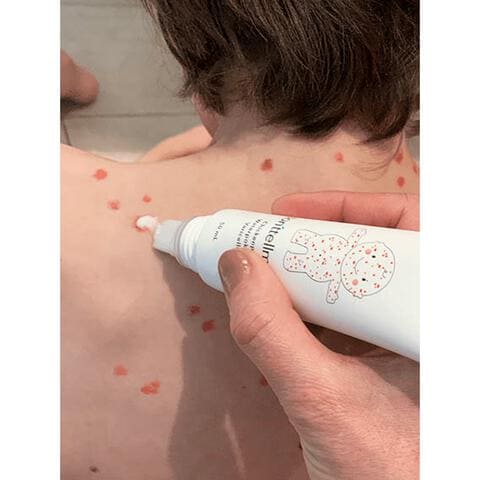 donttellmum Waterpokken Behandeling 50 ML