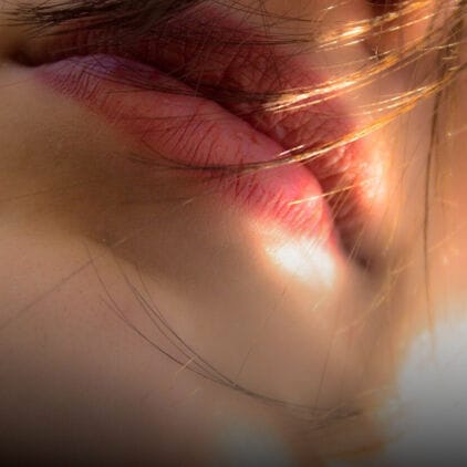 Droge lippen: wat te doen tegen schrale lippen?