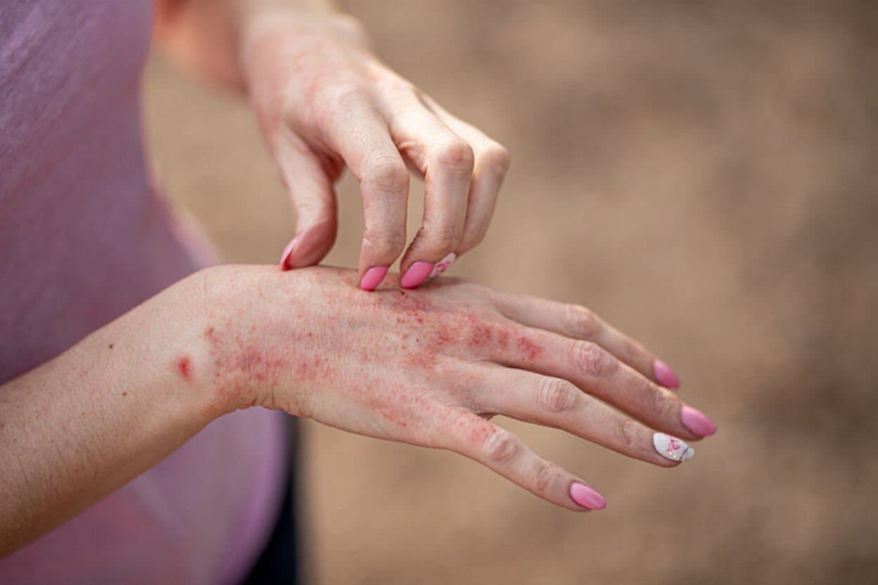 Blote rug vrouw met haar handen erop