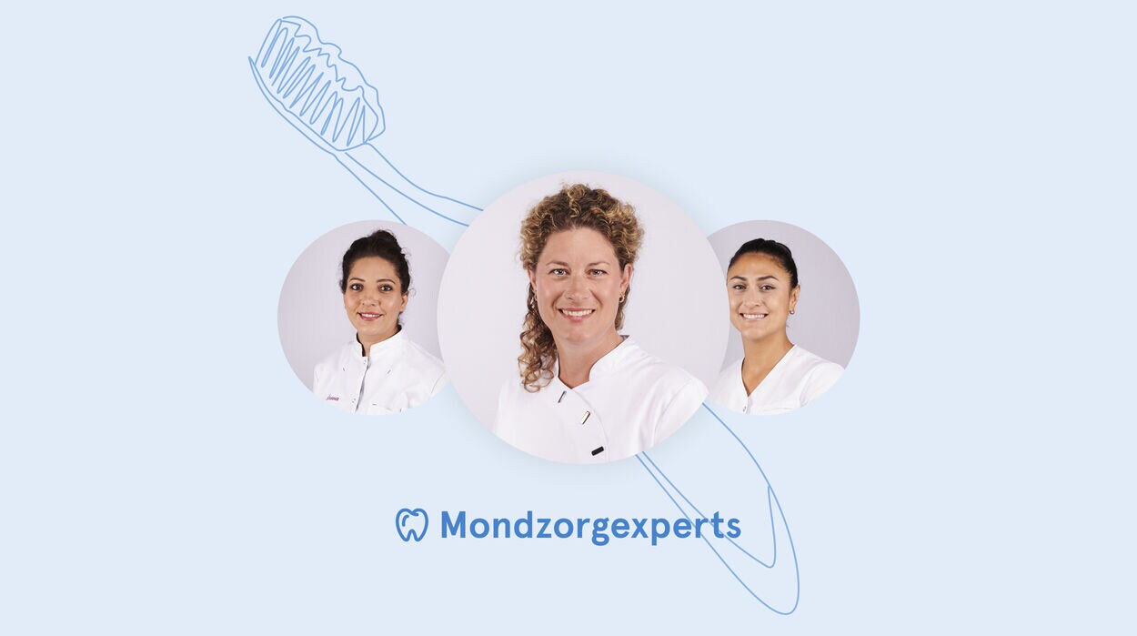 experts mondanalyse