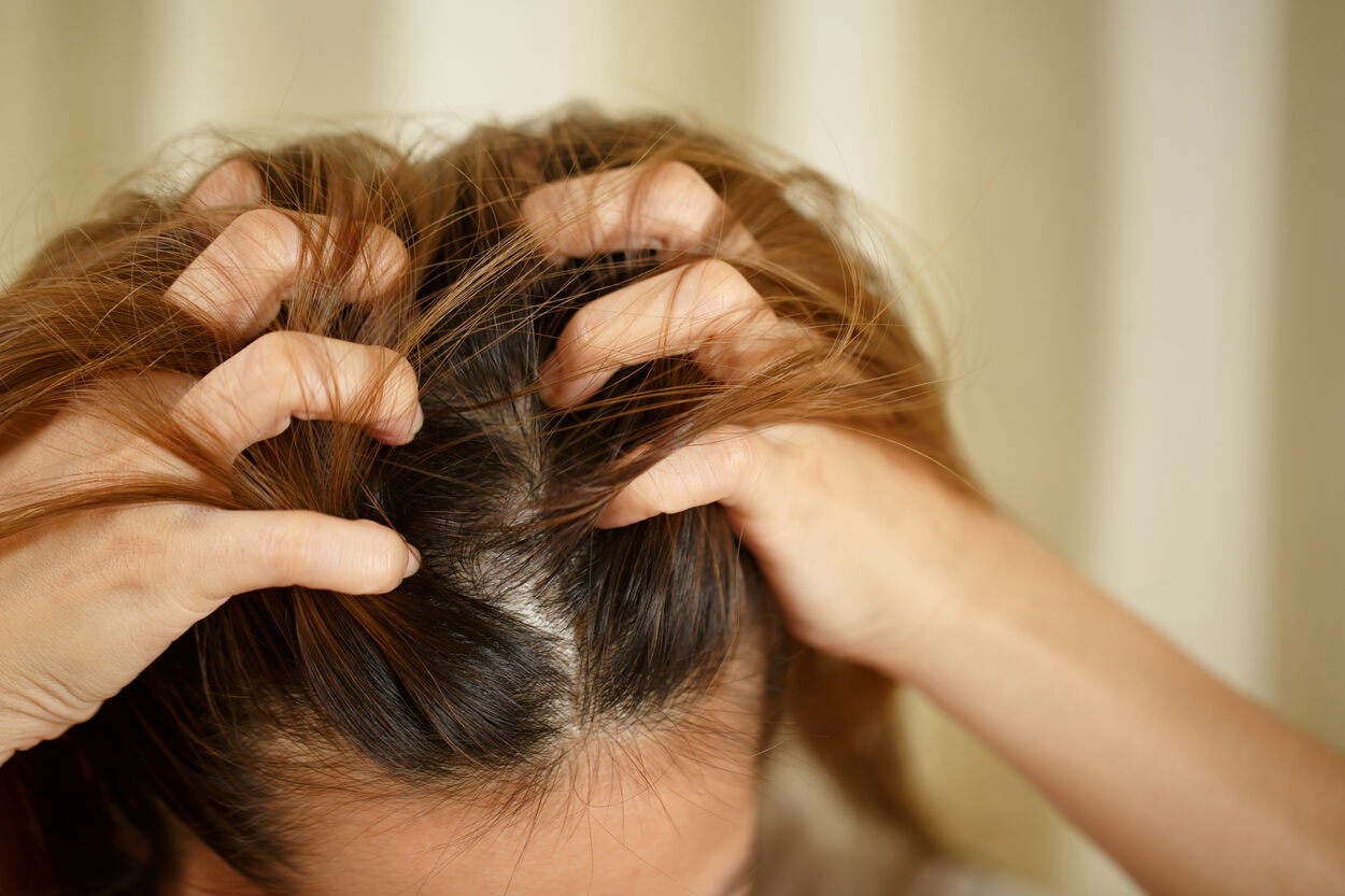 Vrouw die met haar handen in het haar zit, omdat ze veel last heeft van een jeukende hoofdhuid.