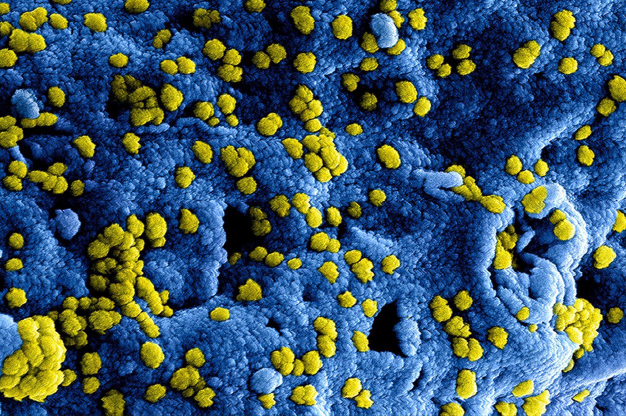 Coronavirus