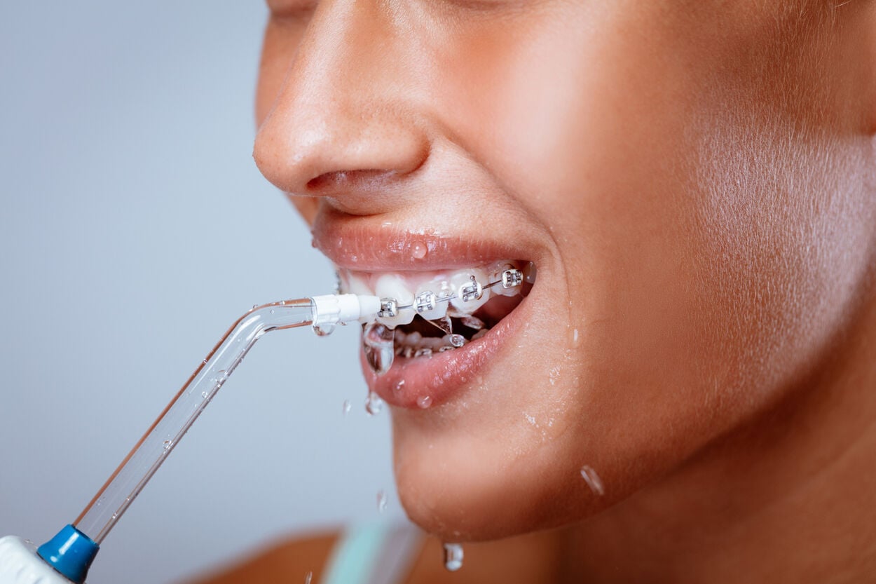 waterflossen - vrouw reinigt tanden met waterflosser