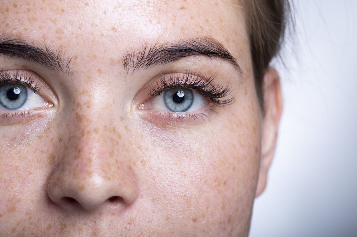 Zoom in foto van een vrouw met helder blauwe ogen. Ze heeft last van bewegende vlekken en flitsen in haar ogen.