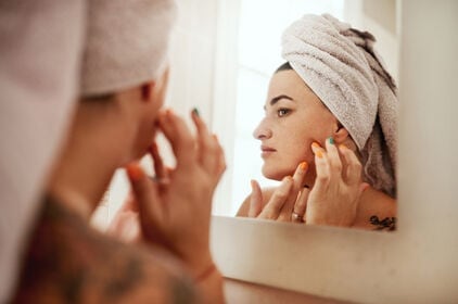 Puistjes? Dit helpt écht tegen puistjes