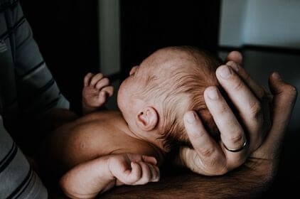Baby-acne: wat kan je doen?