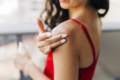 Schilferende huid: wat kan je doen?