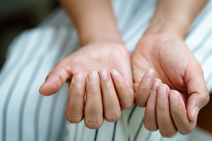 Brosse nagels: waarom breken nagels af? | Etos